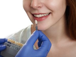 lente de contato dental